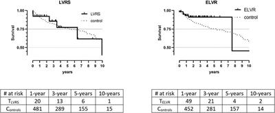 Lung Volume Reduction Followed by Lung Transplantation in Emphysema—A Multicenter Matched Analysis